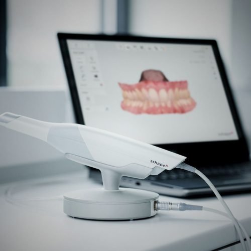 Intraoral-Scanner.jpg